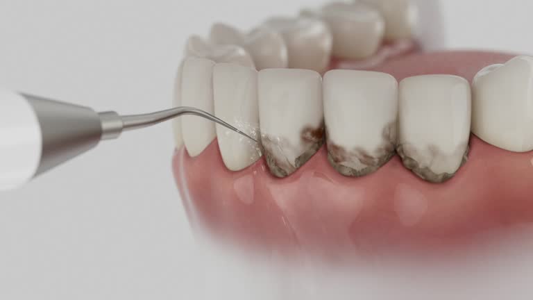 Reliable Dental contractor in Canton, MO by Dentist Open Now